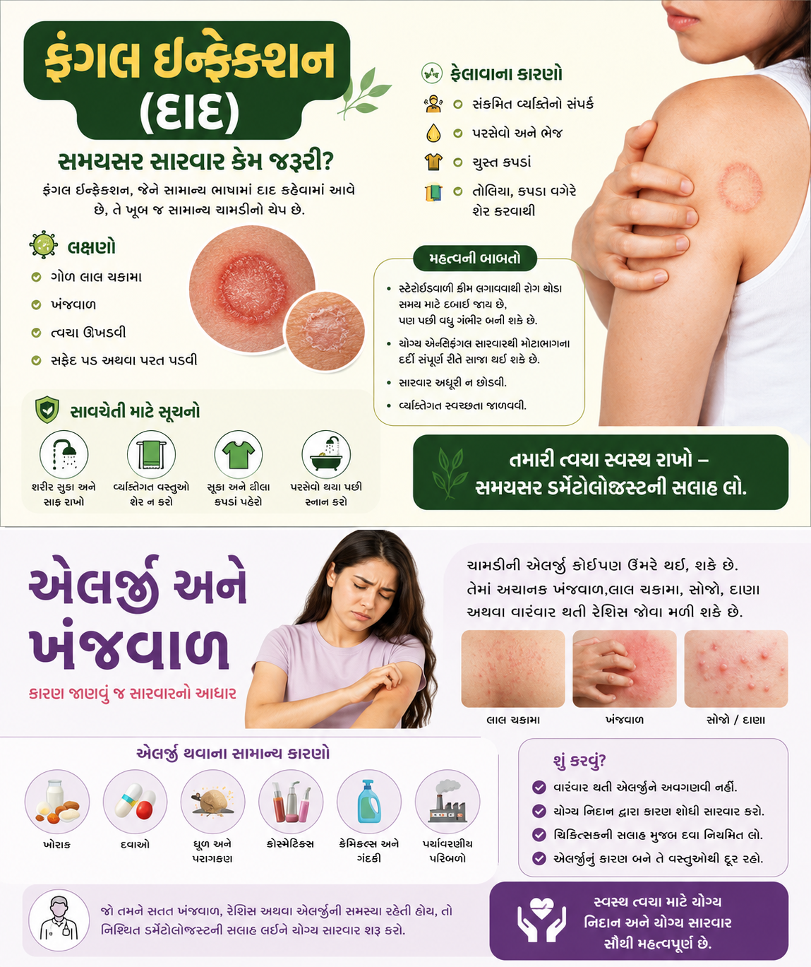 ફંગલ ઇન્ફેક્શન (ધાધર ): જાણો કારણ, લક્ષણો, સારવાર અને બચાવ